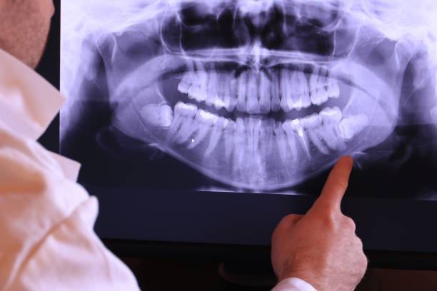 Best Broken or Cracked Tooth Emergency Dentist in Spotswood, NJ